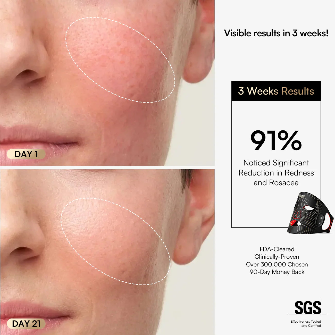 INIA Wireless Red Light Therapy Mask
