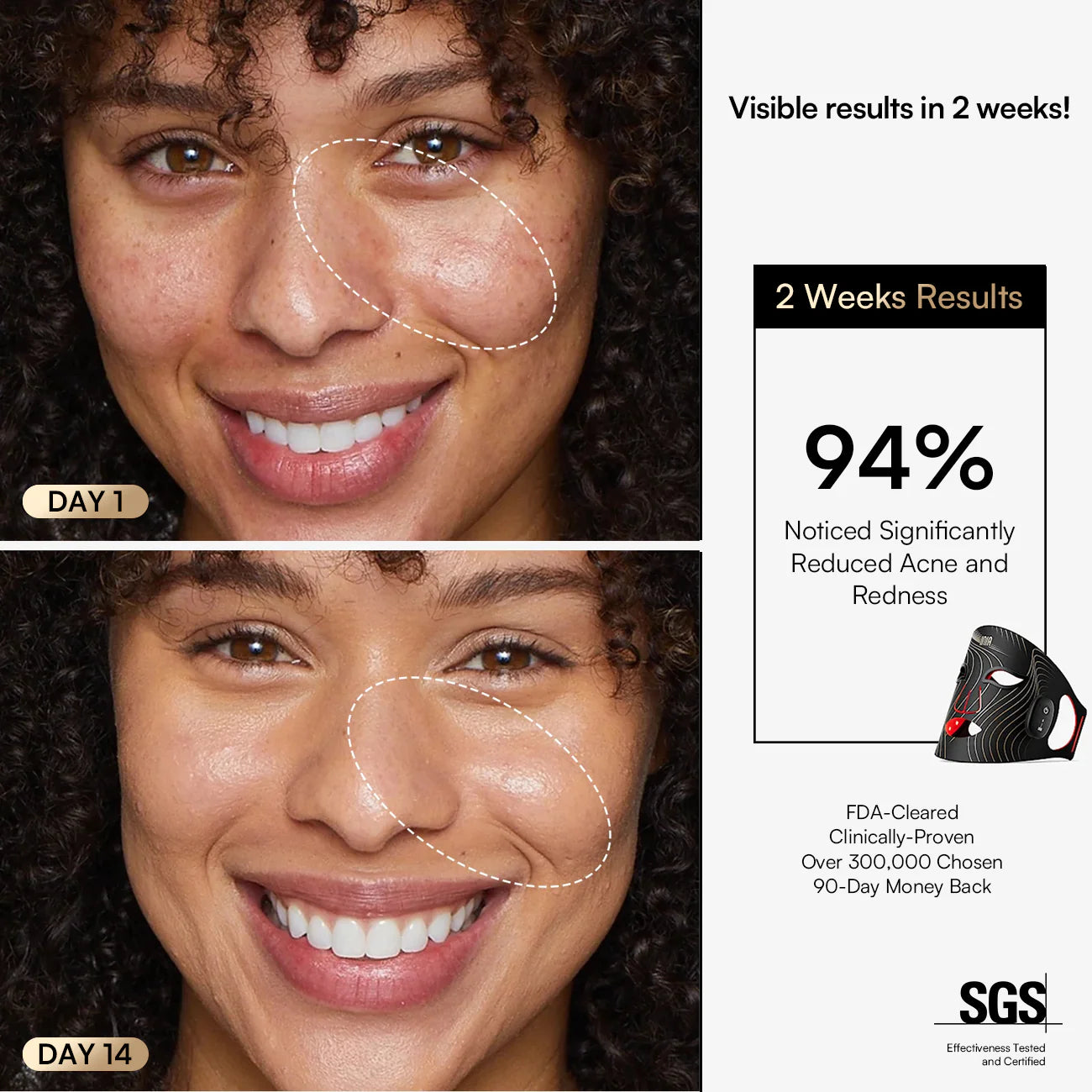 INIA Wireless Red Light Therapy Mask
