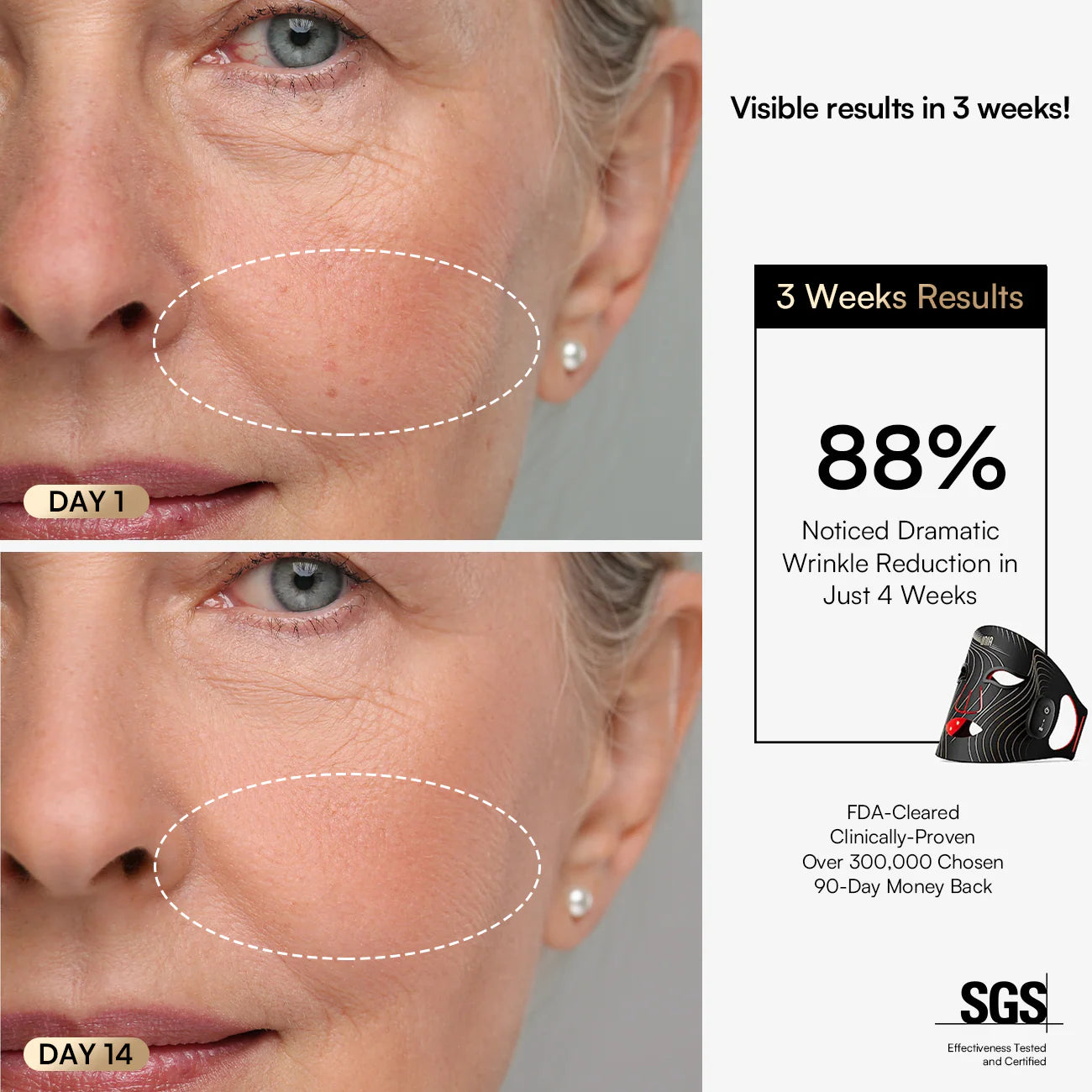 INIA Wireless Red Light Therapy Mask