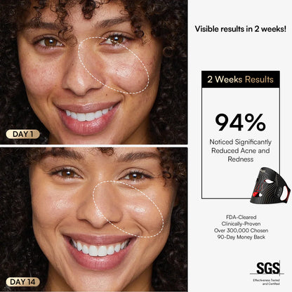 INIA  Wireless Red Light Therapy Mask
