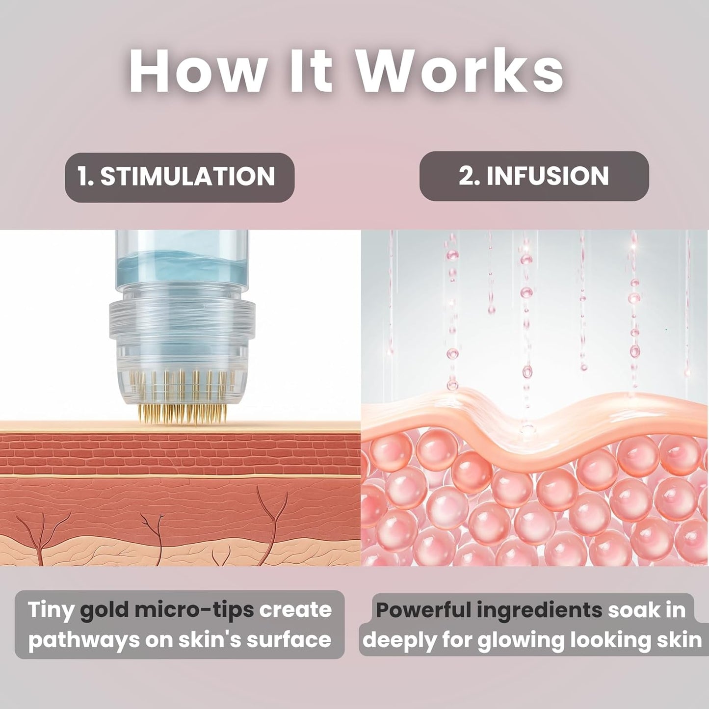 Glov Micro Infusion System